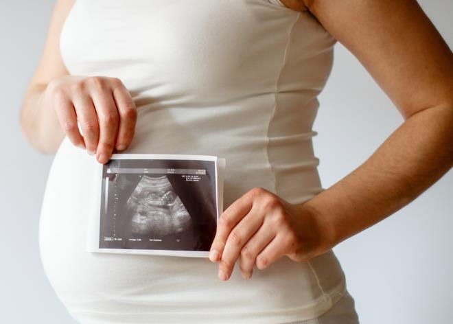 胎儿有肾盂分离、肾盂扩张