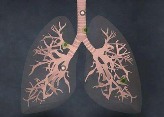 肺病