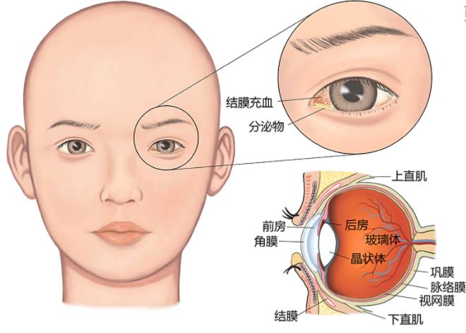 眼结膜位置图片
