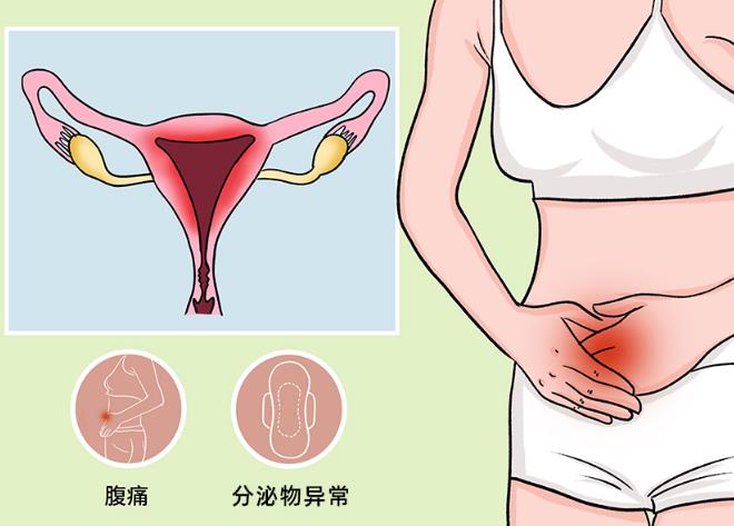 女性盆腔疼痛位置图片图片