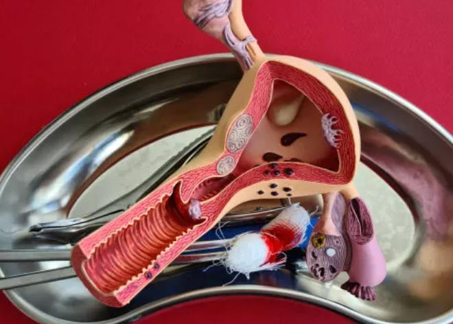 子宫切除肠线吸收过程图片